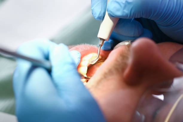 Best Weekend Emergency Dentist in Lake Como, NJ