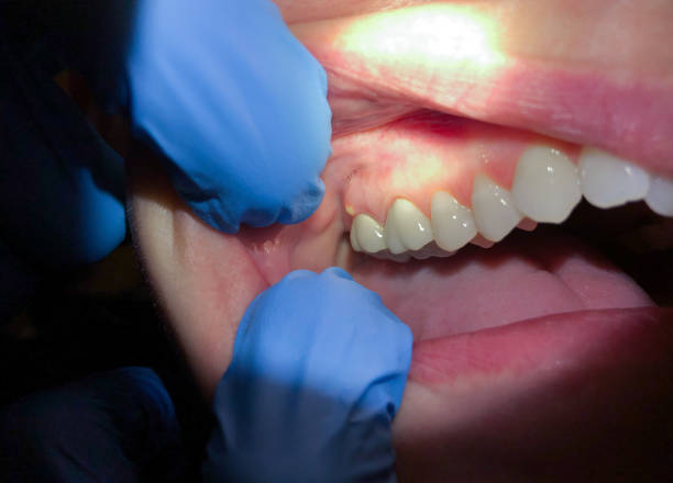 Best Weekend Emergency Dentist in Lake Como, NJ