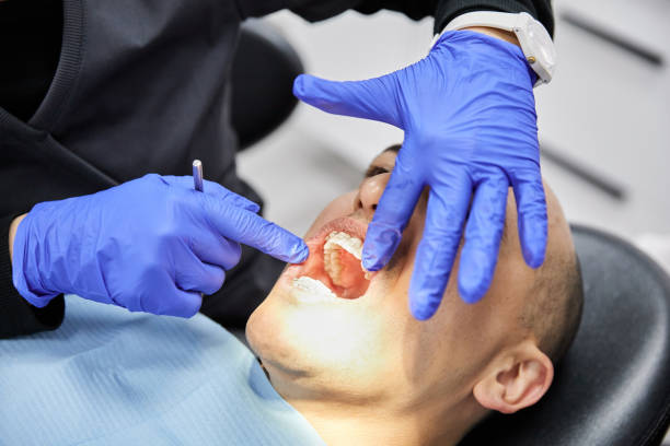 Best Broken or Cracked Tooth Emergency Dentist in Lake Como, NJ